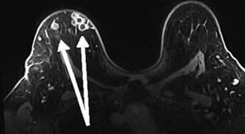 Key image 1