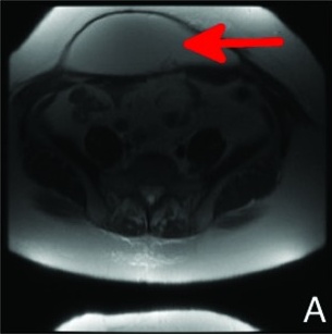 Key image 1
