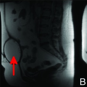 Key image 2
