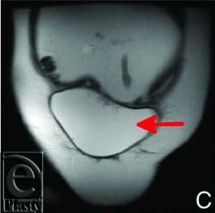 Key image 3