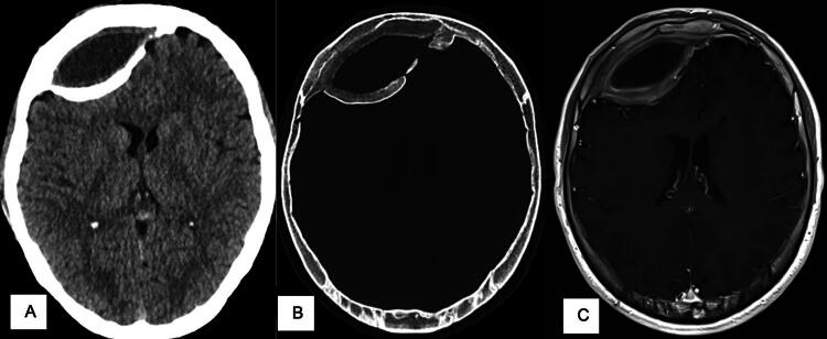 Key image 1