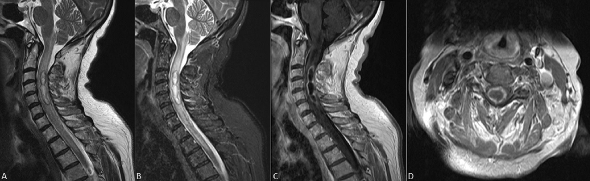 Key image 1