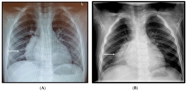 Key image 1