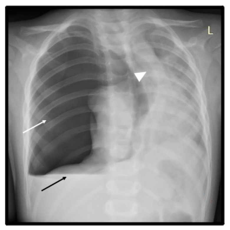 Key image 3