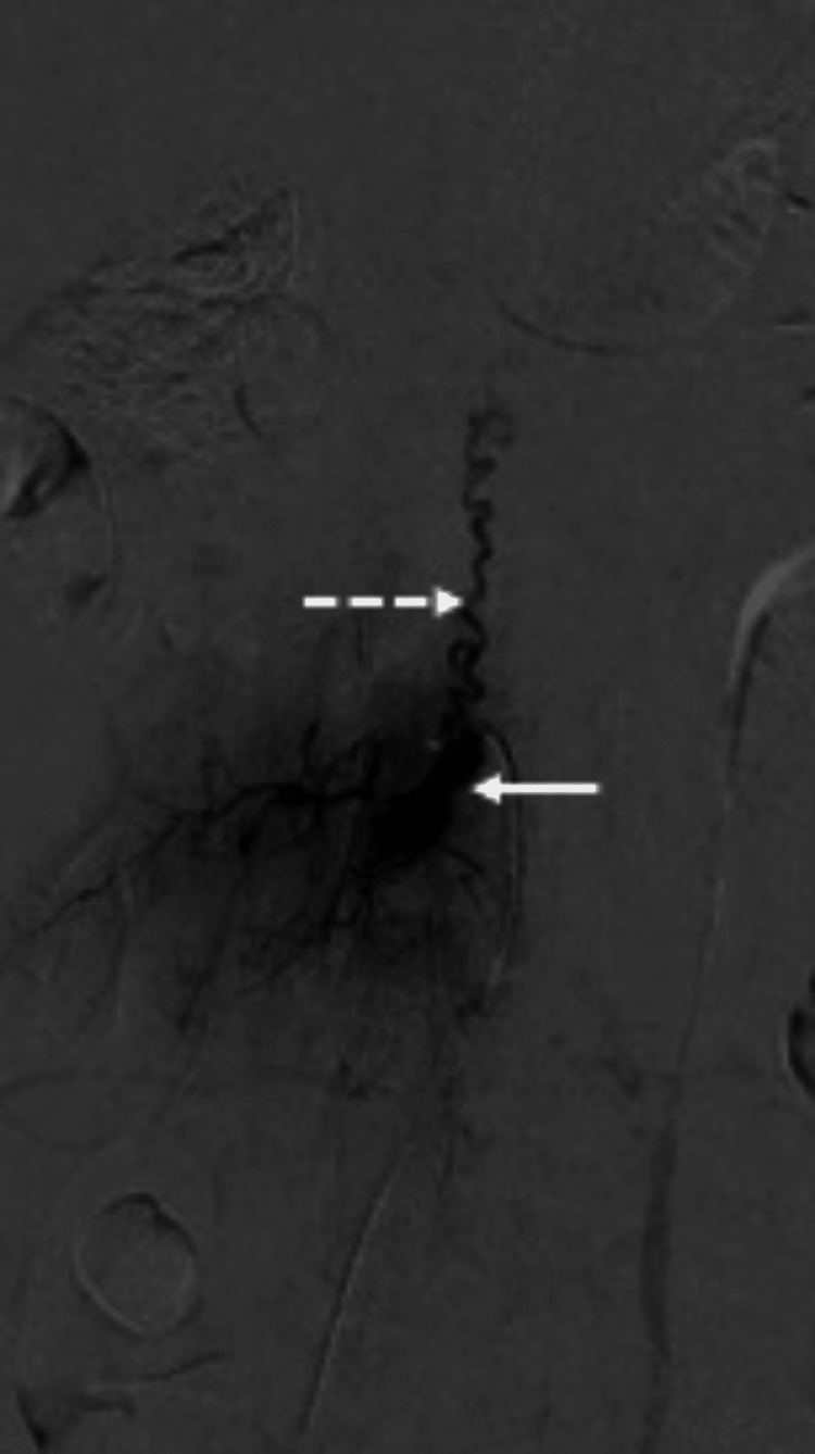 Key image 2