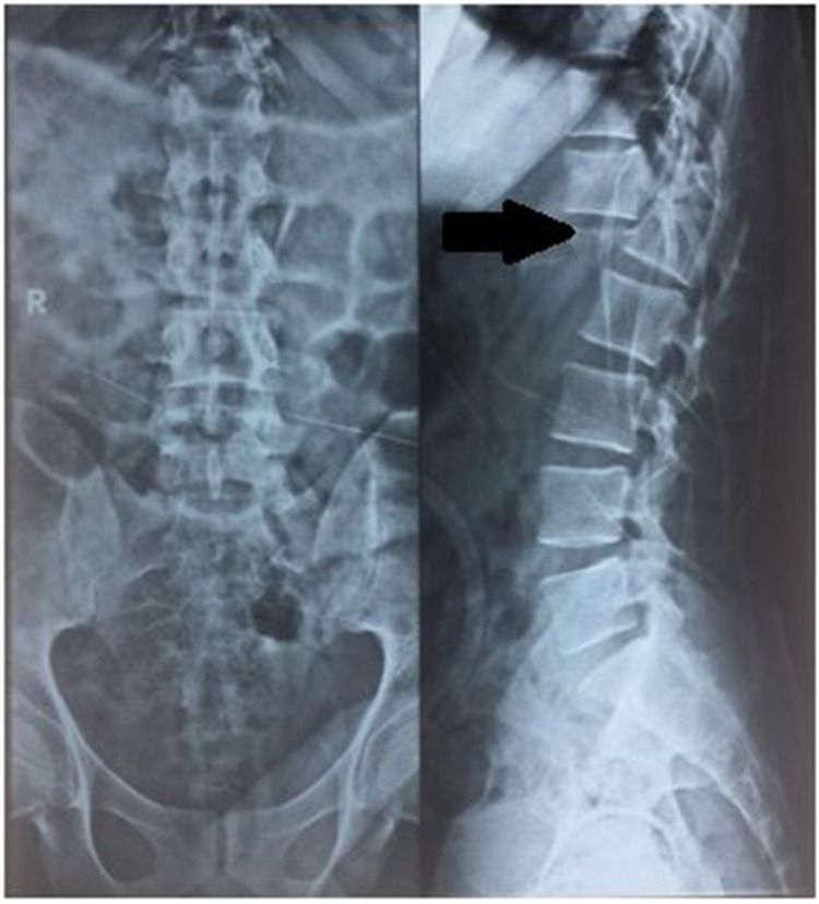 Key image 1