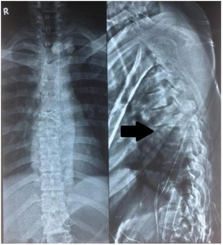 Key image 2