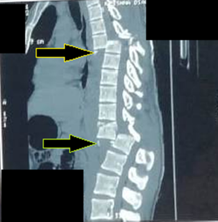 Key image 3