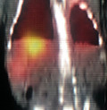 Key image 1