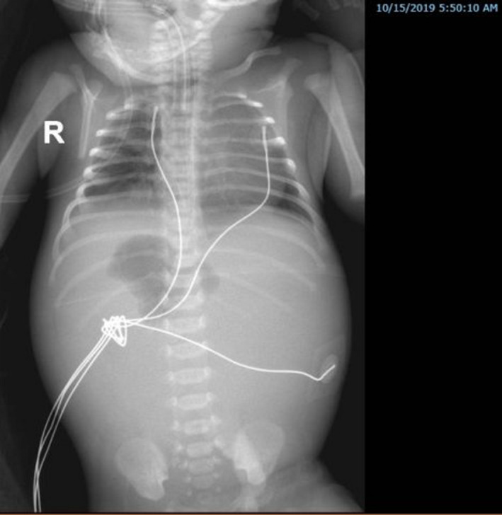 Key image 2