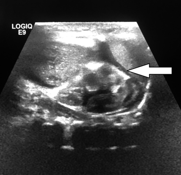 Key image 3