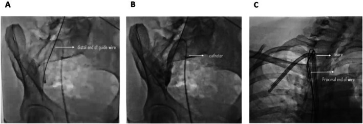 Key image 1