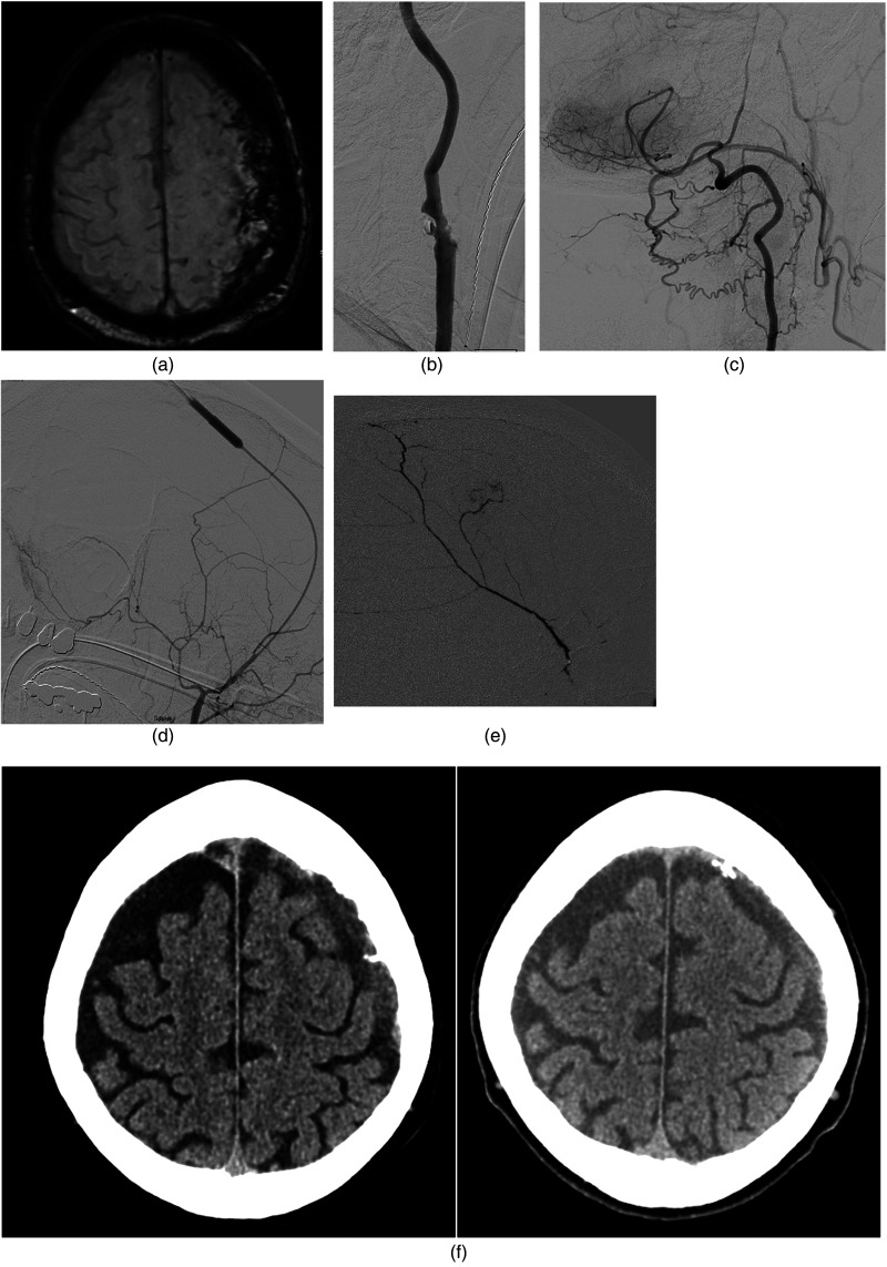 Key image 1