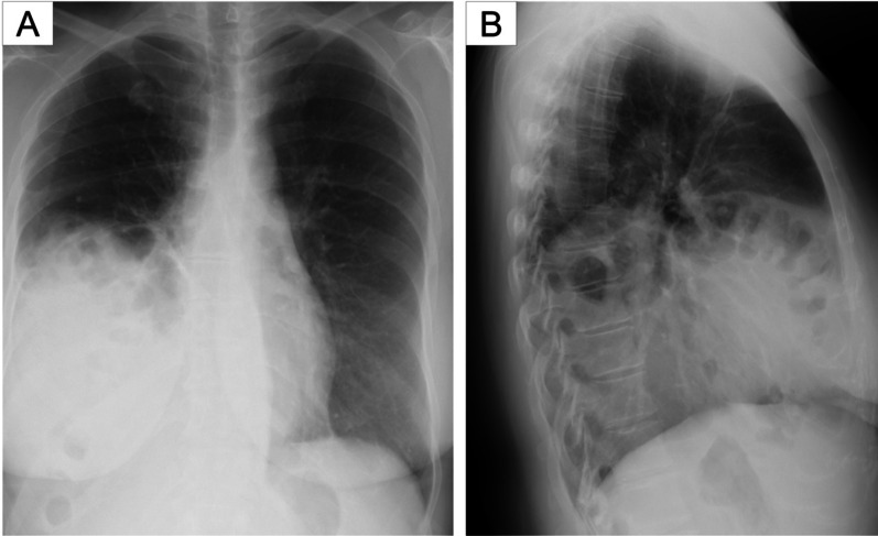 Key image 1