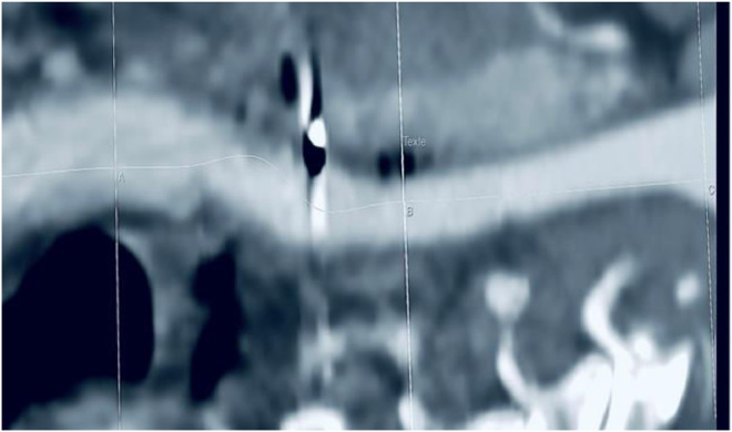 Key image 3