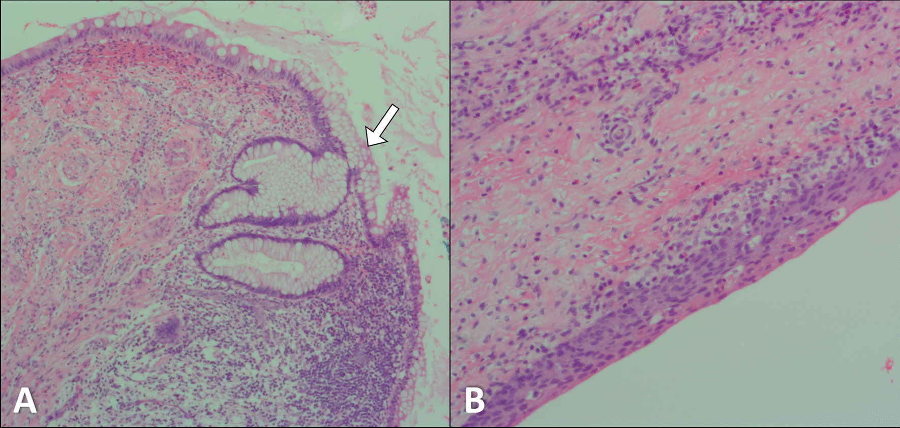 Key image 3