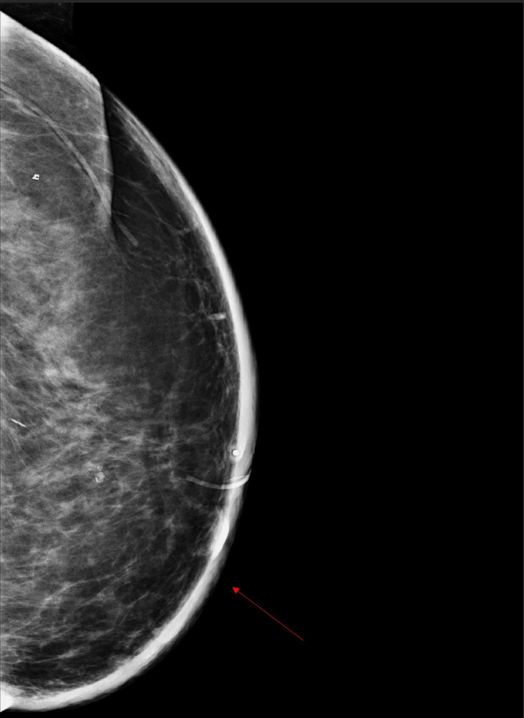 Key image 2