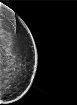 Key image 2