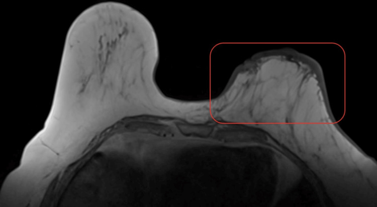 Key image 3