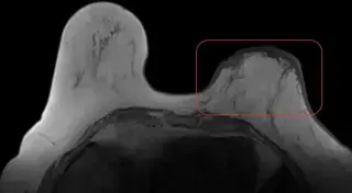 Key image 3