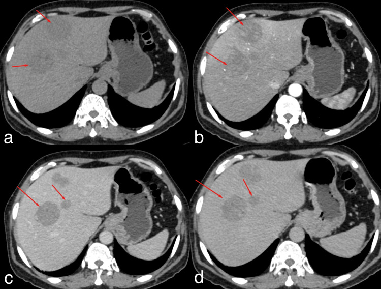 Key image 2