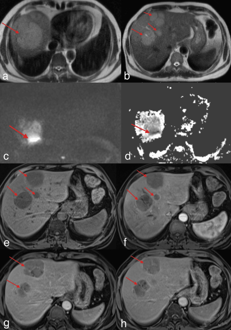 Key image 3