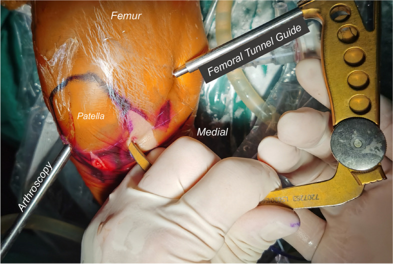 Key image 3