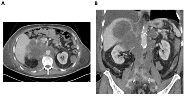 Key image 1