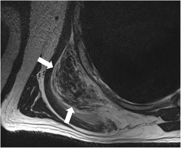 Key image 2