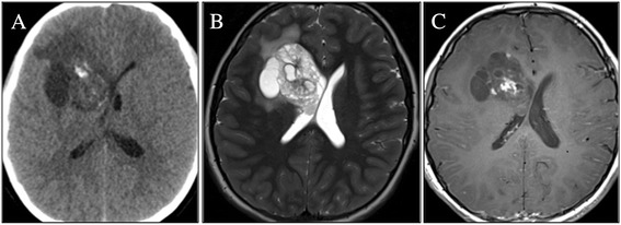 Key image 1