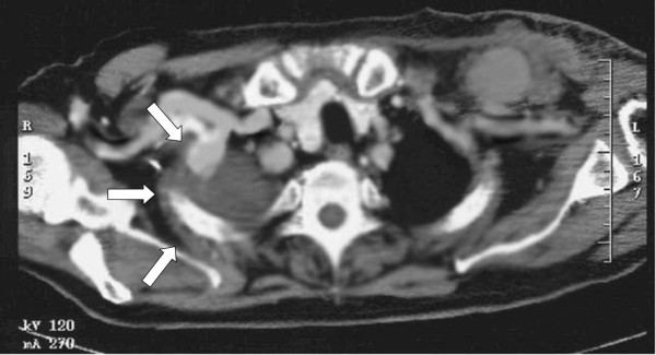 Key image 1