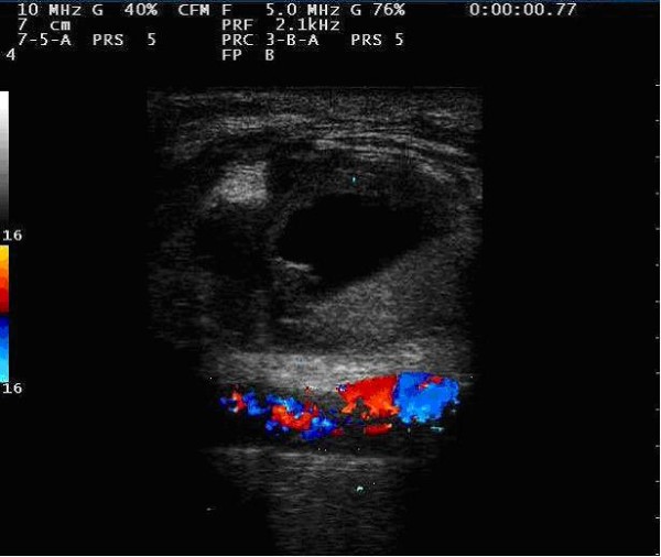Key image 3