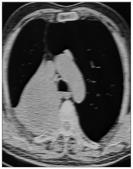 Key image 1
