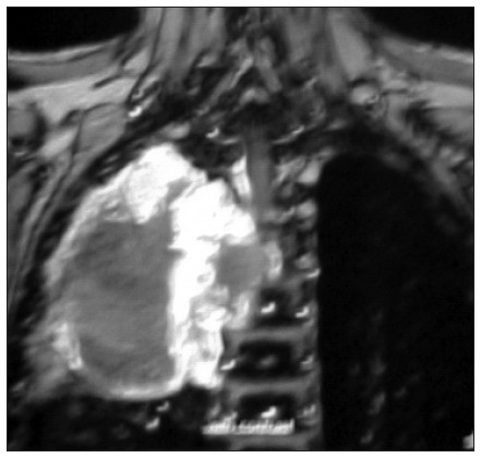 Key image 2