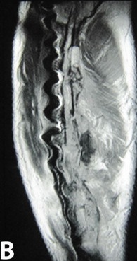 Key image 2