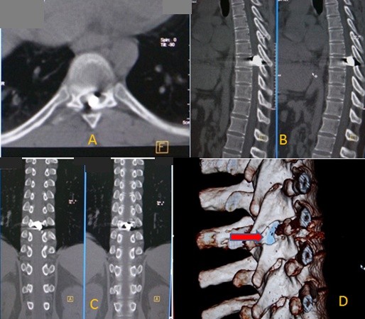 Key image 1