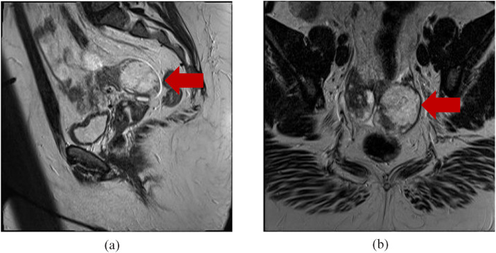 Key image 3