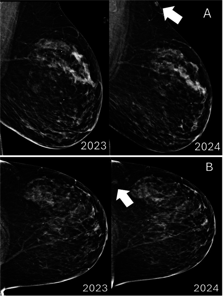 Key image 1