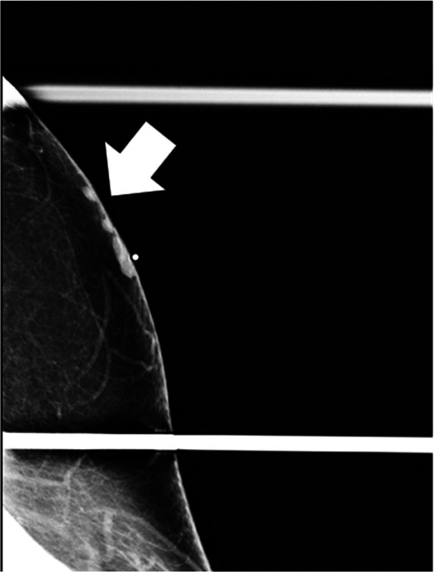 Key image 2