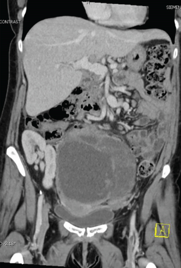 Key image 1