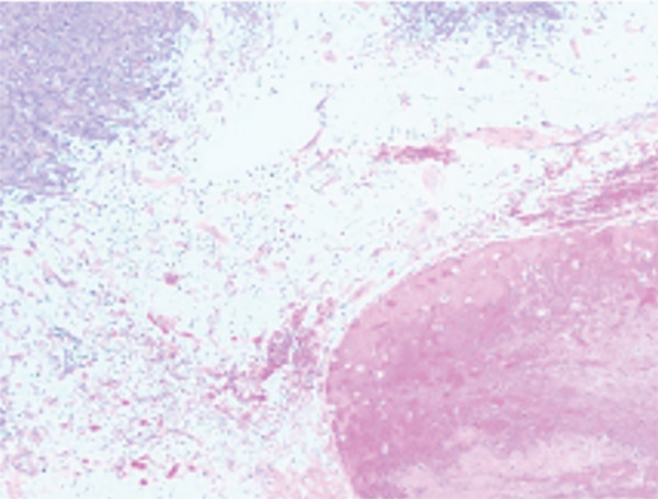 Key image 2