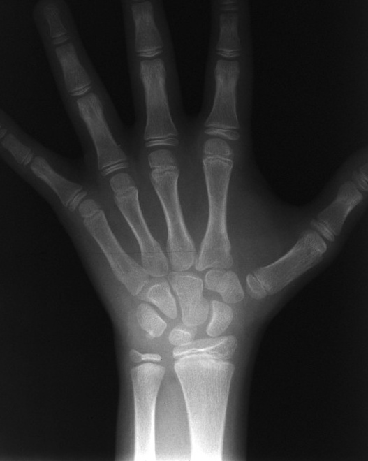 Key image 1