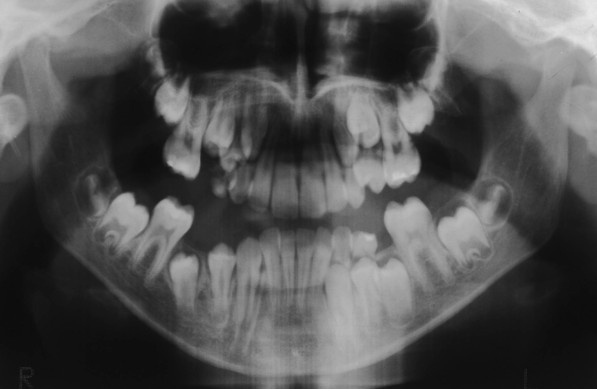 Key image 2