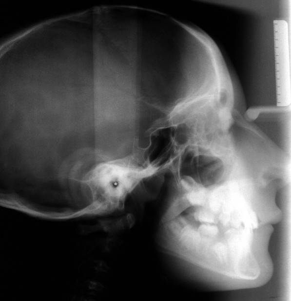 Key image 4