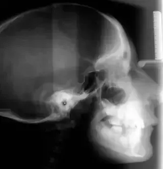 Key image 4