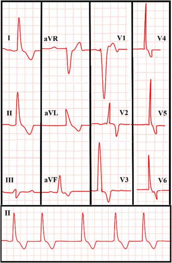 Key image 3