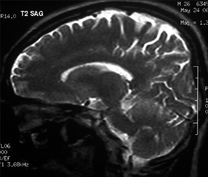 Key image 2