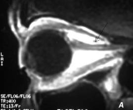 Key image 3