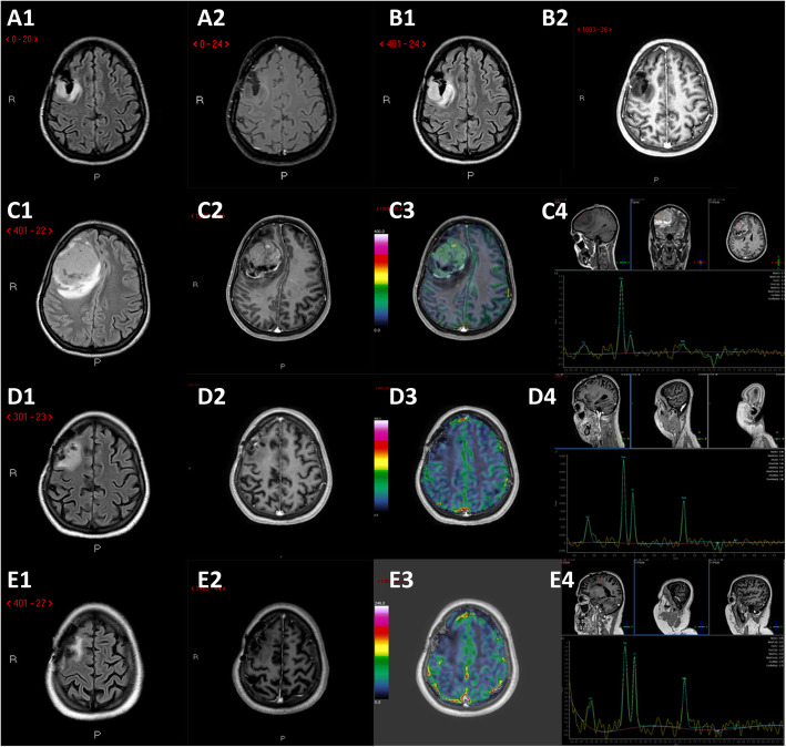 Key image 1