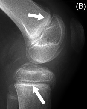 Key image 1